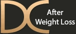 After Weight Loss